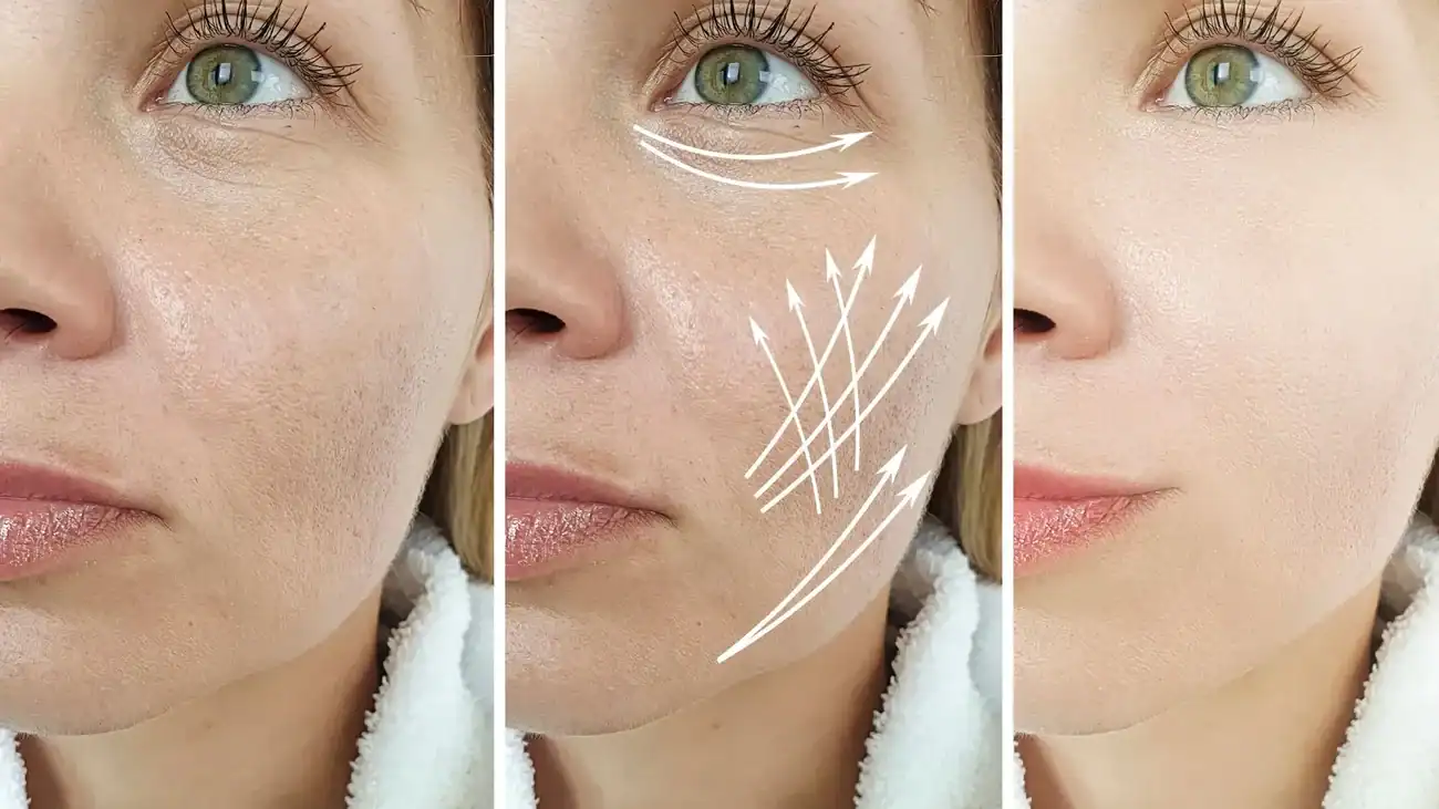 Can One Treatment Really Tackle More Than One Skin Concern Purfleet?