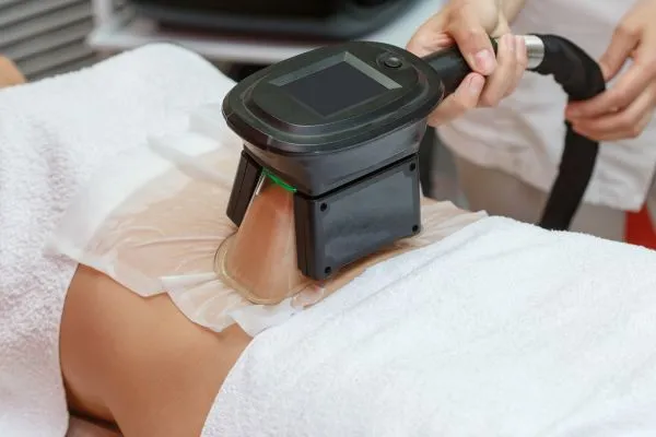 Image of person having fat freezing treatment to help weight gain Purfleet