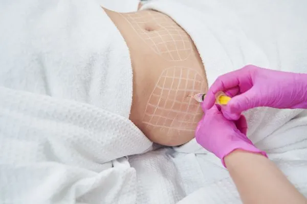 image of fat dissolving injections on love handles to help combat weight gain Purfleet