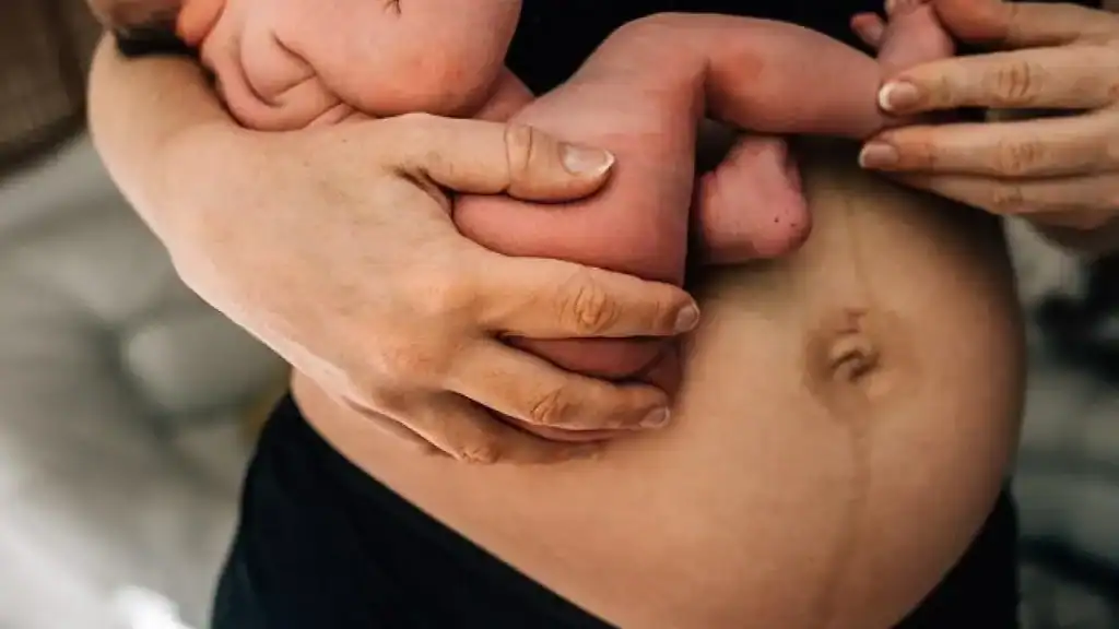 Why Is My Stomach Still Big After Pregnancy Purfleet?